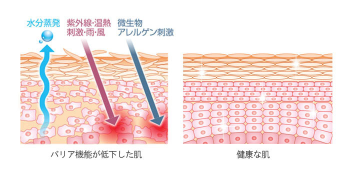 ライスパワーバリアケア肌図荒れた肌健康な肌バリア機能比較